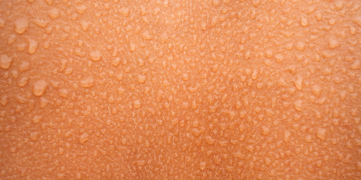 gocce di sudore sulla pelle